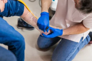 Burn Injuries from Accidents in Illinois: Severity, Liability, and What You Can Recover